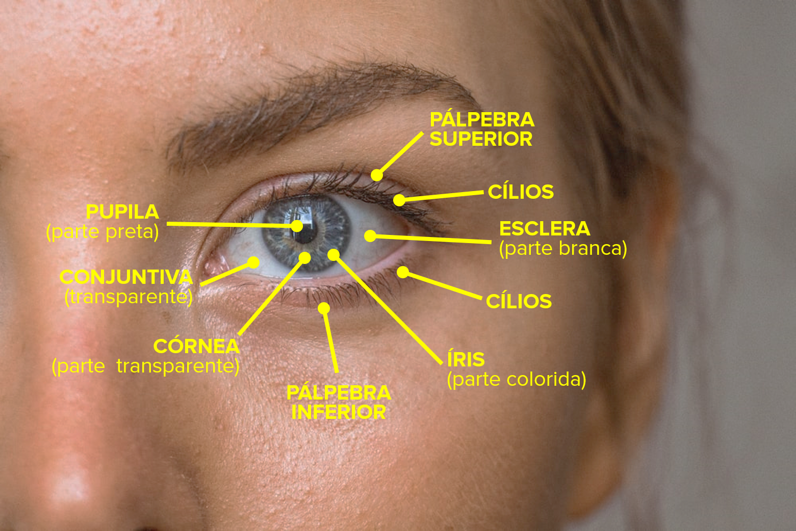 Glaucoma: Um silêncio perturbador